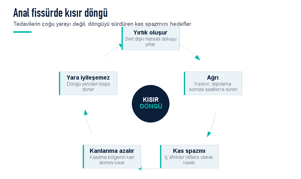 Anal fissürde kısır döngü şeması: yırtık, ağrı, kas spazmı, kanlanmanın azalması ve yaranın iyileşememesi