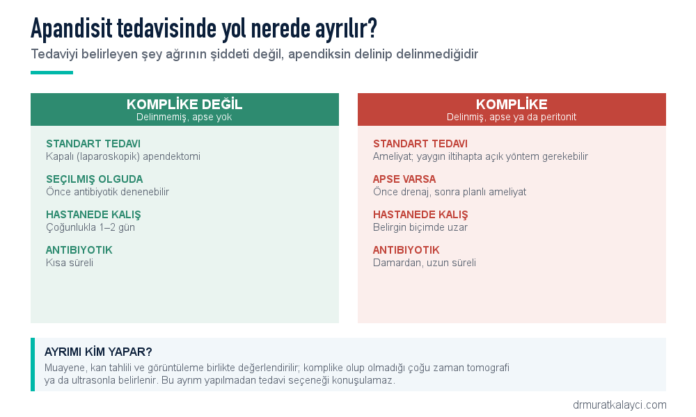 Apandisit tedavisinde komplike olmayan ve komplike tabloların karşılaştırması: standart tedavi, antibiyotik, hastanede kalış süresi