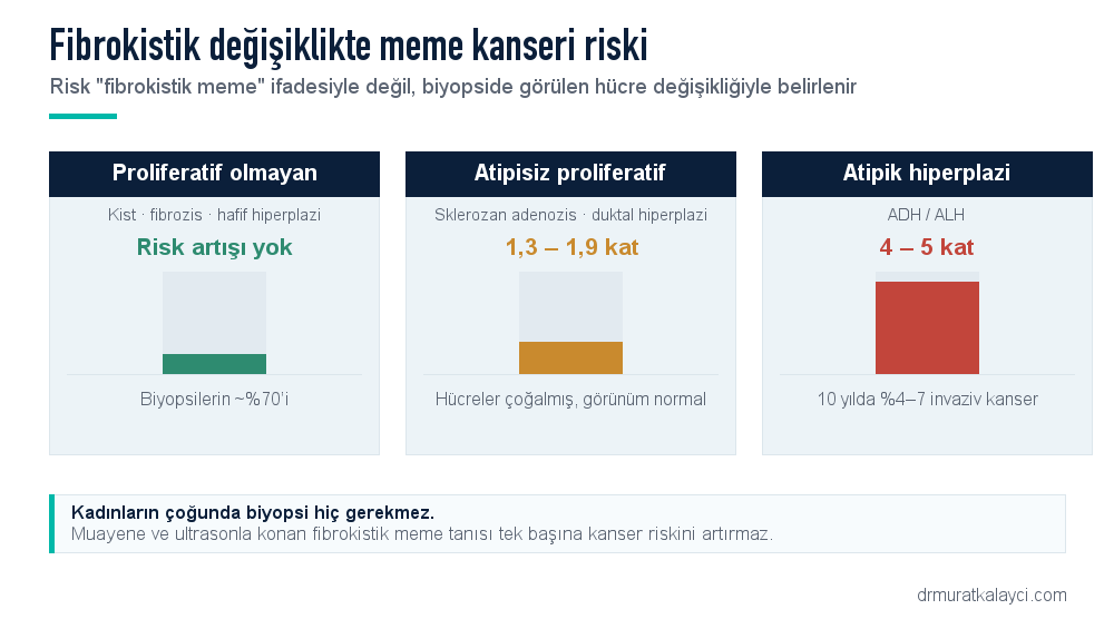Fibrokistik değişiklikte meme kanseri riski basamakları: proliferatif olmayan değişikliklerde risk artışı yok, atipisiz proliferatif değişikliklerde 1,3–1,9 kat, atipik hiperplazide 4–5 kat