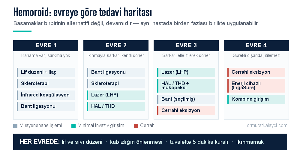 Hemoroid evrelerine göre tedavi seçenekleri: evre 1'de lif ve ilaç, evre 2'de bant ligasyonu ve skleroterapi, evre 2-3'te lazer ve HAL, evre 3-4'te cerrahi eksizyon
