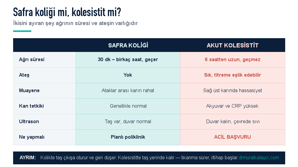 Safra koliği ile akut kolesistitin karşılaştırması: kolikte ağrı birkaç saatte geçer ve ateş yoktur, kolesistitte ağrı sürer, ateş ve hassasiyet eklenir
