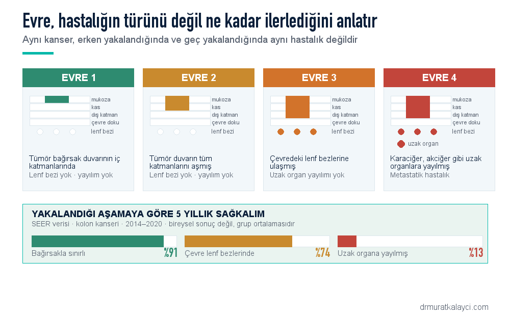 Kolon kanseri evreleri: evre 1 duvarın iç katmanları, evre 2 duvarın tamamı, evre 3 lenf bezleri, evre 4 uzak organ yayılımı; evrelere göre beş yıllık sağkalım oranları