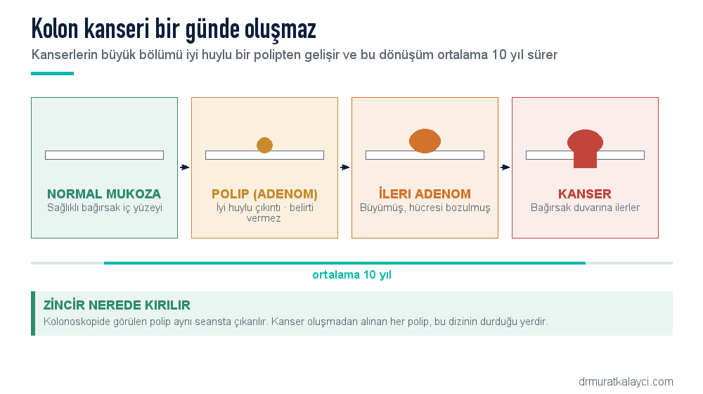 Kolon kanserinin oluşum aşamaları: normal mukoza, polip (adenom), ileri adenom ve kanser; dönüşüm ortalama 10 yıl sürer