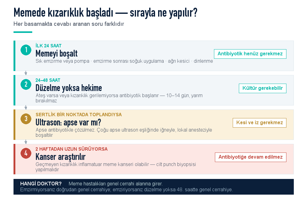 Meme enfeksiyonunda basamak basamak yol haritası: ilk 24 saat memeyi boşaltma, 24–48 saat antibiyotik, apse için ultrason eşliğinde boşaltma, iki haftadan uzun süren kızarıklıkta cilt biyopsisi