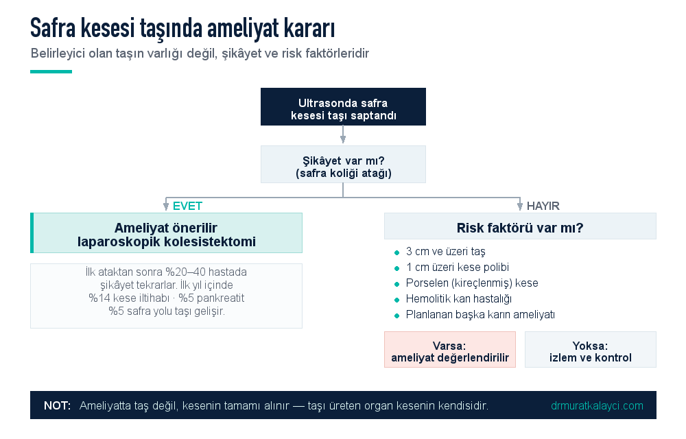Safra kesesi taşında ameliyat kararı akış şeması: şikâyet varsa ameliyat önerilir, şikâyet yoksa risk faktörlerine göre izlem veya ameliyat değerlendirilir