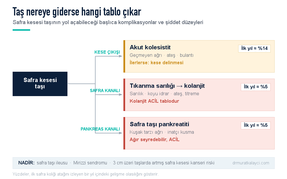 Safra kesesi taşının yol açabileceği komplikasyonlar: kese çıkışının tıkanmasıyla kolesistit, ana safra kanalında tıkanma sarılığı ve kolanjit, pankreas kanalı etkilenirse pankreatit