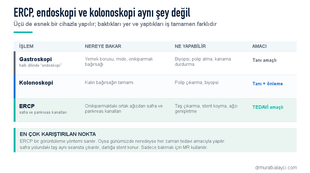 ERCP, gastroskopi ve kolonoskopi karşılaştırması: nereye bakar, ne yapabilir, amacı nedir