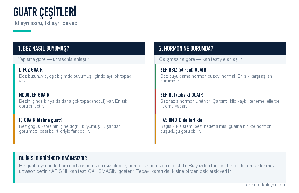 Guatr çeşitleri: difüz, nodüler, iç guatr ile zehirsiz, zehirli ve Hashimoto'ya eşlik eden guatr