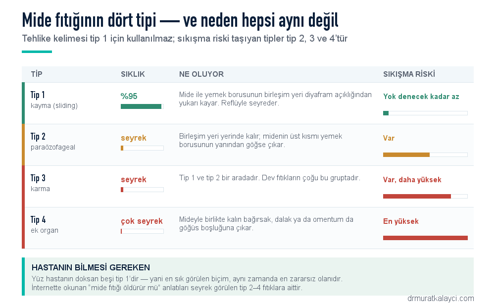 Mide fıtığının dört tipi: kayma (tip 1) yüzde 95, paraözofageal (tip 2), karma (tip 3) ve ek organ içeren (tip 4) tiplerin sıkışma riski karşılaştırması